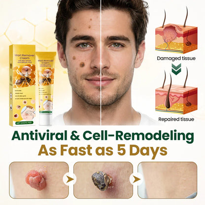 Alcuras® Wart Remover Cream with Bee Venom and Salicylic Acid – Skin Tag Removal & Skin Repair Formula for Face and Body