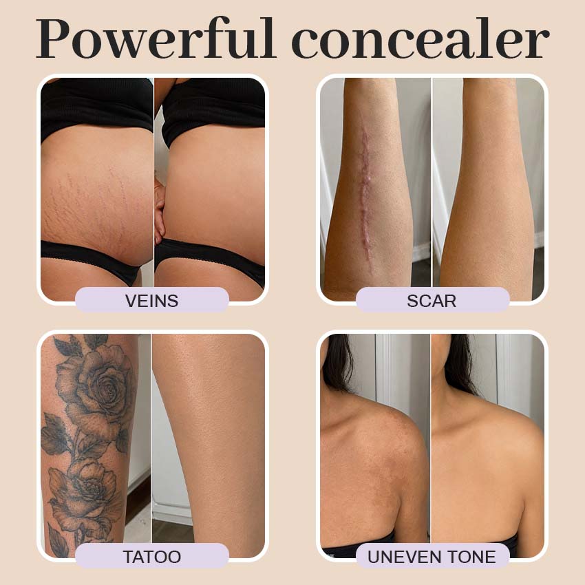 Alcuras® Body Concealer Cream