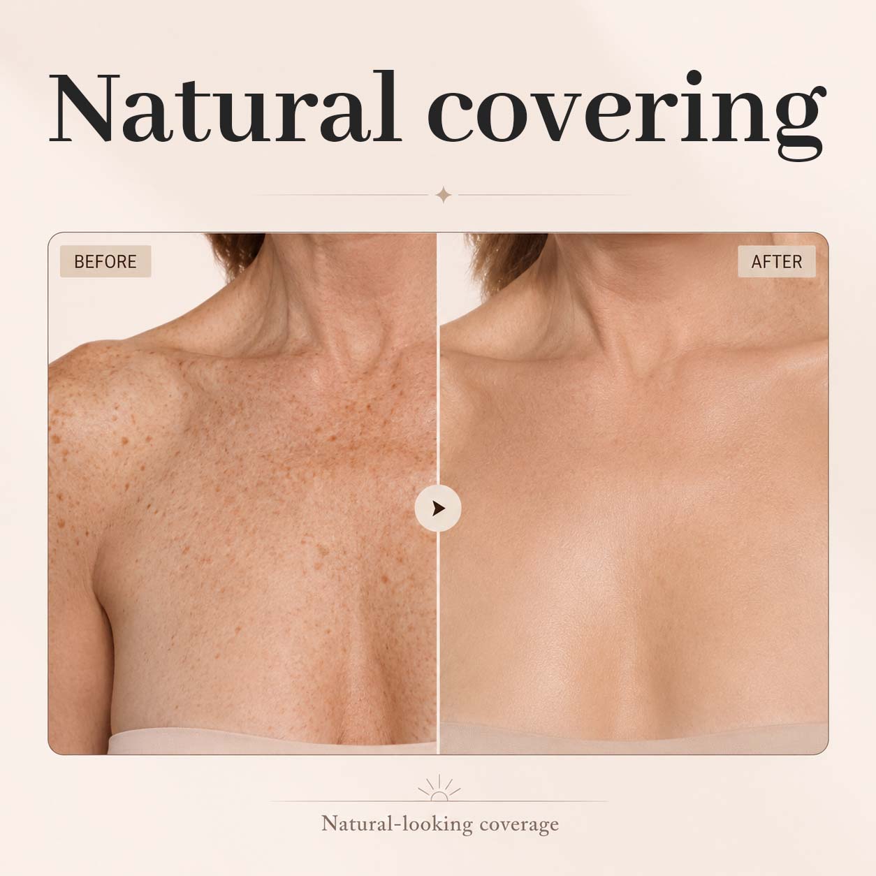 Alcuras® Body Concealer Cream