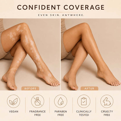 Alcuras® Body Concealer Cream